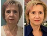 Naturalne odmładzanie – zadbaj o swoją urodę bez chemii! - zdjęcie 1